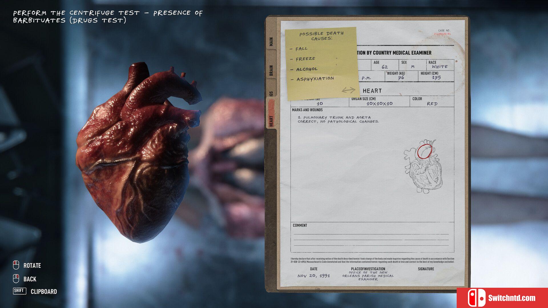 《验尸模拟器（Autopsy Simulator）》官方中文 FLT镜像版[CN/TW/EN/JP]_3